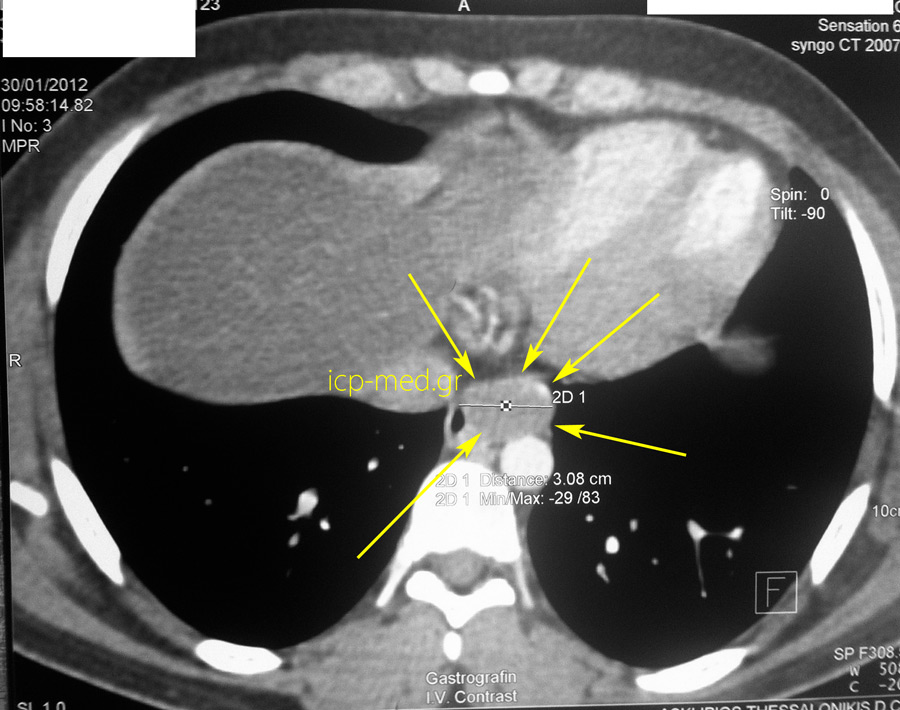 5.Preop imaging: axial view